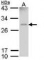 GSTM1 / MU Antibody